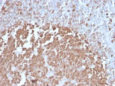 Immunohistochemistry-Paraffin: BOB1 Antibody (BOB1/2422) [NBP3-08637] - Formalin-fixed, paraffin-embedded human Tonsil stained with BOB1 Mouse Monoclonal Antibody (BOB1/2422).