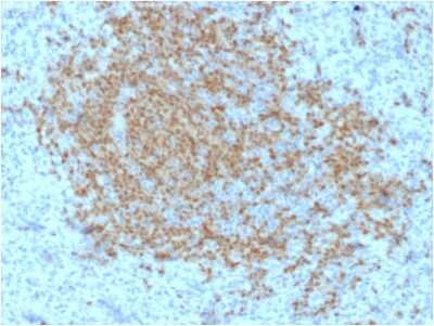 Immunohistochemistry-Paraffin: BOB1 Antibody (BOB1/2423) [NBP3-08666] - Formalin-fixed, paraffin-embedded human Spleen stained with BOB1 Mouse Monoclonal Antibody (BOB1/2423).
