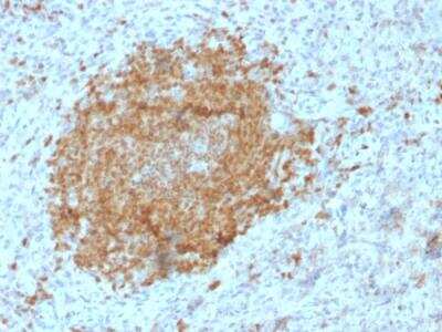 Immunohistochemistry-Paraffin: BOB1 Antibody (BOB1/2425) - Azide and BSA Free [NBP2-75757] - Formalin-fixed, paraffin-embedded human Spleen stained with BOB1 Mouse Monoclonal Antibody (BOB1/2425).