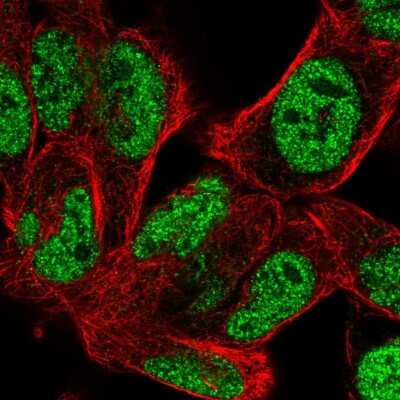 Immunocytochemistry/Immunofluorescence: BOC Antibody [NBP2-56289] - Staining of human cell line RH-30 shows localization to nucleoplasm.