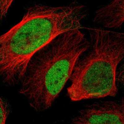 Immunocytochemistry/Immunofluorescence: BOC Antibody [NBP2-57618] - Staining of human cell line U-2 OS shows localization to nucleoplasm.