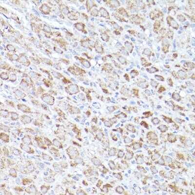 Immunohistochemistry-Paraffin: BOK Antibody [NBP2-92315] - Rat ovary using BOK Rabbit pAb (NBP2-92315) at dilution of 1:100 (40x lens). Perform high pressure antigen retrieval with 10 mM citrate buffer pH 6.0 before commencing with IHC staining protocol.