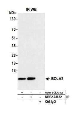 Immunoprecipitation: BOLA2 Antibody [NBP2-78832] - Detection of human BOLA2 by western blot of immunoprecipitates. Samples: Whole cell lysate (1.0 mg per IP reaction; 20% of IP loaded) from OVCAR-4 cells prepared using NETN lysis buffer. Antibodies: Affinity purified rabbit anti-BOLA2 antibody NBP2-78832 used for IP at 100 ul per reaction. BOLA2 was also immunoprecipitated by another rabbit anti-BOLA2 antibody. For blotting immunoprecipitated BOLA2, NBP2-78832 was used at 1:1000. Detection: Chemiluminescence with an exposure time of 10 seconds.