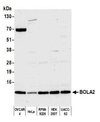 Western Blot: BOLA2 Antibody [NBP2-78832] - Detection of human BOLA2 by western blot. Samples: Whole cell lysate (15 ug) from OVCAR-4, HeLa, RPMI-8226, HEK293T, and UACC-62 cells prepared using NETN lysis buffer. Antibody: Affinity purified rabbit anti-BOLA2 antibody NBP2-78832 used for WB at 1:1000. Detection: Chemiluminescence with an exposure time of 10 seconds.