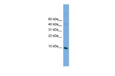 Western Blot: BOLA2 Antibody [NBP3-10445] - Western blot analysis of BOLA2 in SP2/0 cell lysate as a positive control. Antibody dilution at 0.2-1 ug/ml