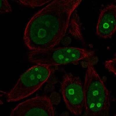 Immunocytochemistry/Immunofluorescence: BOP1 Antibody [NBP2-56455] - Staining of human cell line PC-3 shows localization to nucleus & nucleoli.