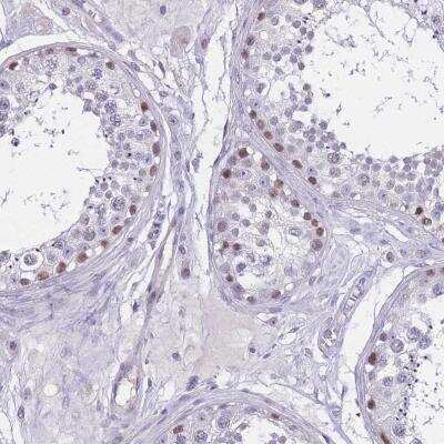 Immunohistochemistry-Paraffin: BOP1 Antibody [NBP2-33504] - Staining of human testis shows nuclear positivity in seminiferus ducts.