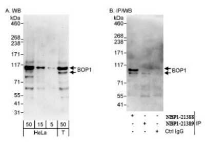 Western Blot: BOP1 Antibody [NBP1-21388] - on HeLa whole cell lysate using affinity purified rabbit anti-BOP1 antibody. BOP1 was  also immunoprecipitated by rabbit anti-BOP1 antibody  NBP1-21389.