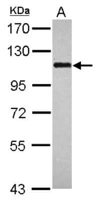 Western Blot: BOP1 Antibody [NBP2-15606] - Sample (30 ug of whole cell lysate) A: HeLa 7. 5% SDS PAGE gel, diluted at 1:1000.