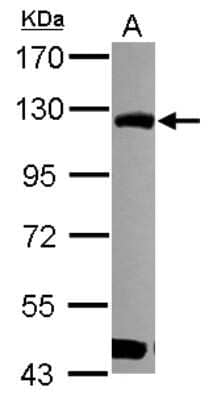 Western Blot: BOP1 Antibody [NBP2-15607] - Sample (30 ug of whole cell lysate) A: A549 7. 5% SDS PAGE gel, diluted at 1:1000.