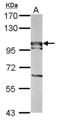 Western Blot: BOP1 Antibody [NBP2-15607] - Sample (50 ug of whole cell lysate) A: Mouse Liver, 7. 5% SDS PAGE gel, diluted at 1:1000.