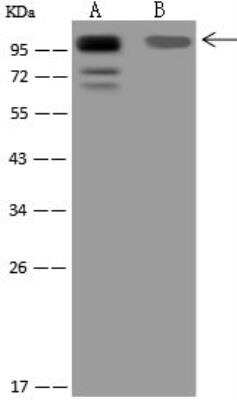 Western Blot: BOP1 Antibody [NBP3-12594] - Lane A: HeLa Whole Cell LysateLane B: 293T Whole Cell LysateLysates/proteins at 30 ug per lane.SecondaryGoat Anti-Rabbit IgG (H+L)/HRP at 1/10000 dilution.Developed using the ECL technique.Performed under reducing conditions.Predicted band size:94 kDaObserved band size:100 kDa(We are unsure as to the identity of these extra bands.)