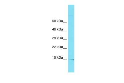 Western Blot: BORCS7 Antibody [NBP2-82769] - Host: Rabbit. Target Name: C10orf32. Sample Type: U937 Whole Cell lysates. Antibody Dilution: 1.0ug/ml