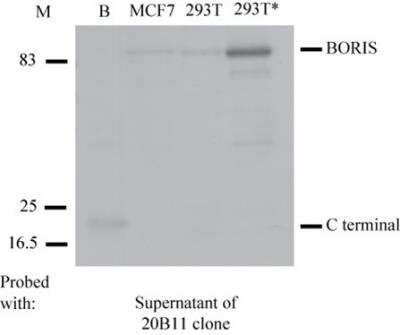 Western Blot: BORIS Antibody (20B11) [NBP2-52405] - Antibody from clone 20B11 specifically recognises the C terminal domain of BORIS, and the endogenous and exogenous BORIS protein. Cell lysates were resolved by SDS-PAGE, blotted and probed with the original mouse supernatant of the 20B11 clone. Positions of BORIS and the C-terminal domain of BORIS are indicated. B, bacterially expressed BORIS;  293T cells transfected with 0.5ug of the plasmid expressing BORIS; M, Molecular marker.