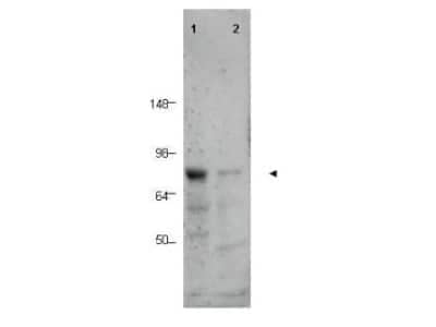 Western Blot: BORIS Antibody [NB100-2028] - Analysis of a predominant band corresponding to BORIS in human tissue lysates (arrowhead). Lane 1 contains lysate from human prostate tissue. Lane 2 contains lysate from human spleen tissue. A predominant band at 75 kDa is observed.