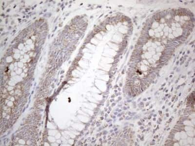 Immunohistochemistry: BP1 Antibody (8A1) [NBP2-46463] - Analysis of Human colon tissue. (Heat-induced epitope retrieval by 1mM EDTA in 10mM Tris buffer (pH8.5) at 120C for 3 min)