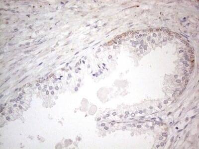 Immunohistochemistry: BP1 Antibody (8A1) [NBP2-46463] - Analysis of Human prostate tissue. (Heat-induced epitope retrieval by 1mM EDTA in 10mM Tris buffer (pH8.5) at 120C for 3 min)