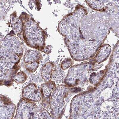 Immunohistochemistry-Paraffin: BP1 Antibody [NBP2-34130] - Staining of human placenta shows cytoplasmic and nuclear positivity in trophoblastic cells.