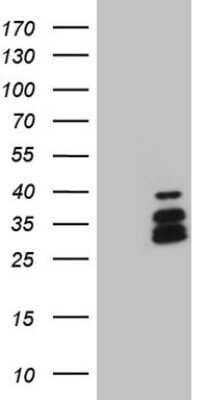 Western Blot: BP1 Antibody (OTI8A1) - Azide and BSA Free [NBP2-70581] - Analysis of HEK293T cells were transfected with the pCMV6-ENTRY control (Left lane) or pCMV6-ENTRY BP1.