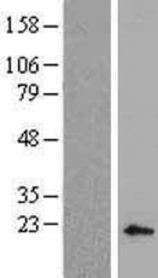 Western Blot: BP1 Overexpression Lysate (Adult Normal) [NBL1-09920] Left-Empty vector transfected control cell lysate (HEK293 cell lysate); Right -Over-expression Lysate for BP1.