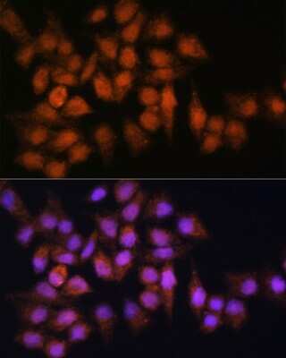 Immunocytochemistry/Immunofluorescence: BPGM Antibody [NBP2-92819] - Immunofluorescence analysis of HeLa cells using BPGM Rabbit pAb (NBP2-92819) at dilution of 1:100. Blue: DAPI for nuclear staining.