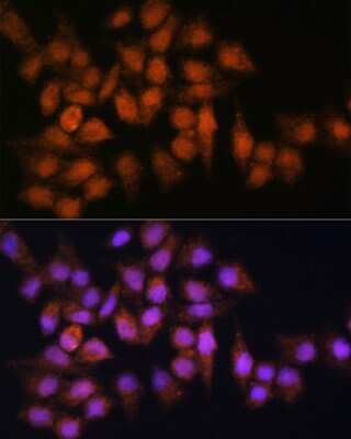 Immunocytochemistry/Immunofluorescence: BPGM Antibody [NBP2-92819] - Immunofluorescence analysis of HeLa cells using BPGM Rabbit pAb (NBP2-92819) at dilution of 1:100. Blue: DAPI for nuclear staining.