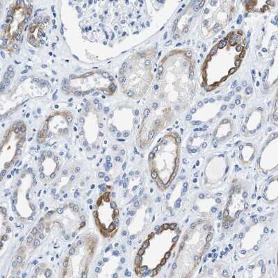 Immunohistochemistry-Paraffin: BPGM Antibody [NBP1-86064] - Staining of human kidney shows weak to moderate cytoplasmic positivity in cells in tubules.