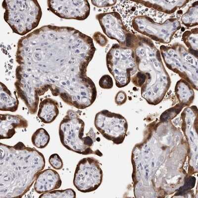 Immunohistochemistry-Paraffin: BPGM Antibody [NBP1-86377] - Staining of human placenta shows strong cytoplasmic and nuclear positivity in trophoblastic cells.