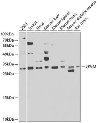 Western Blot: BPGM Antibody [NBP2-92819] - Analysis of extracts of various cell lines, using BPGM at 1:1000 dilution.Secondary antibody: HRP Goat Anti-Rabbit IgG (H+L) at 1:10000 dilution.Lysates/proteins: 25ug per lane.Blocking buffer: 3% nonfat dry milk in TBST.Detection: ECL Basic Kit .Exposure time: 30s.