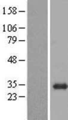 Western Blot: BPGM Overexpression Lysate (Adult Normal) [NBP2-10093] Left-Empty vector transfected control cell lysate (HEK293 cell lysate); Right -Over-expression Lysate for BPGM.