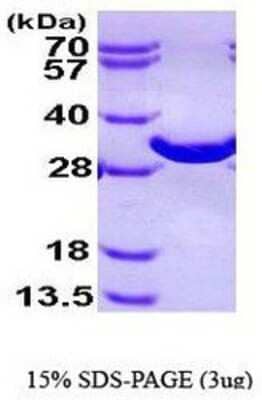 SDS-PAGE Recombinant Human BPGM His Protein