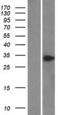 Western Blot: BPHL Overexpression Lysate (Adult Normal) [NBP2-10227] Left-Empty vector transfected control cell lysate (HEK293 cell lysate); Right -Over-expression Lysate for BPHL.