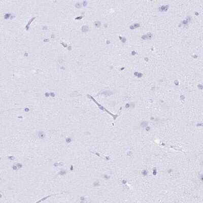 <b>Orthogonal Strategies Validation. </b>Immunohistochemistry-Paraffin: BPI Antibody [NBP2-37982] - Staining of human cerebral cortex shows low expression as expected.