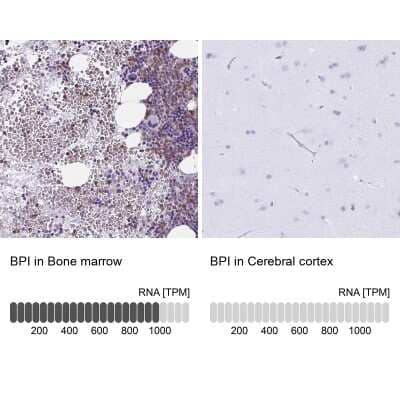 Immunohistochemistry-Paraffin: BPI Antibody [NBP2-37982] - Staining in human bone marrow and cerebral cortex tissues using anti-BPI antibody. Corresponding BPI RNA-seq data are presented for the same tissues.