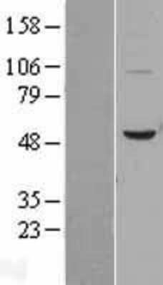 Western Blot: BPI Overexpression Lysate (Adult Normal) [NBL1-08020] Left-Empty vector transfected control cell lysate (HEK293 cell lysate); Right -Over-expression Lysate for BPI.