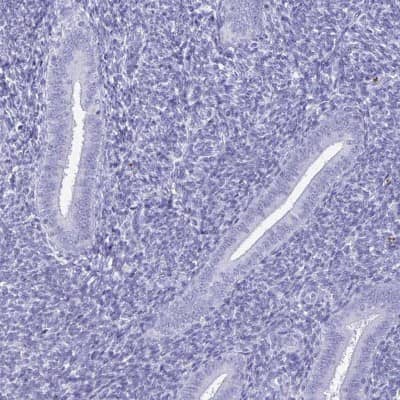 Immunohistochemistry-Paraffin BPIFA3 Antibody