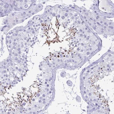 Immunohistochemistry-Paraffin BPIFA3 Antibody