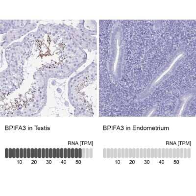 Immunohistochemistry-Paraffin BPIFA3 Antibody