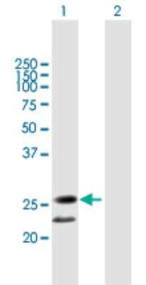 Western Blot BPIFA3 Antibody - Azide and BSA Free