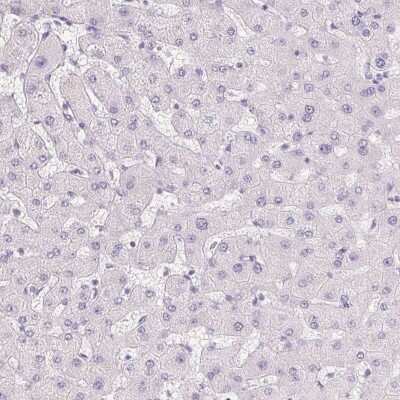 Immunohistochemistry-Paraffin BPIL1 Antibody - BSA Free