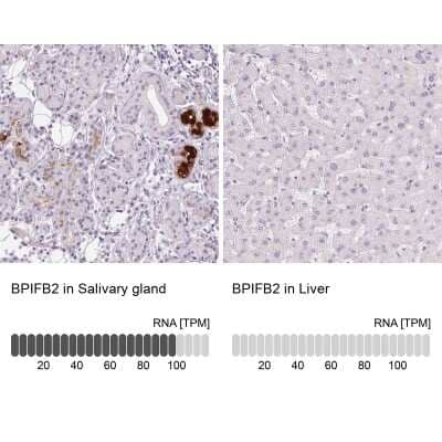 Immunohistochemistry-Paraffin BPIL1 Antibody - BSA Free