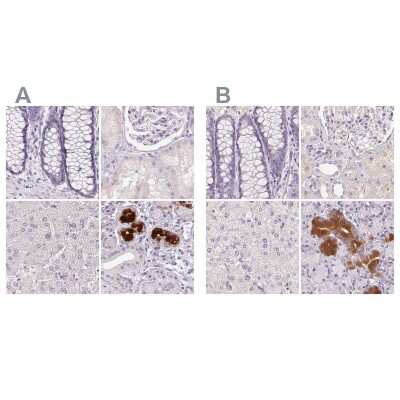 Immunohistochemistry-Paraffin BPIL1 Antibody - BSA Free