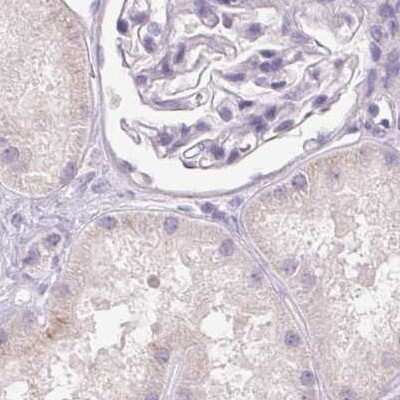Immunohistochemistry-Paraffin BPIL1 Antibody - BSA Free
