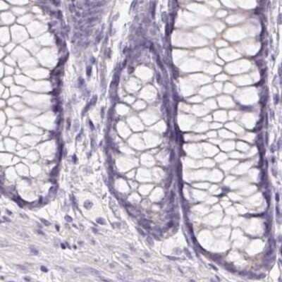 Immunohistochemistry-Paraffin BPIL1 Antibody - BSA Free