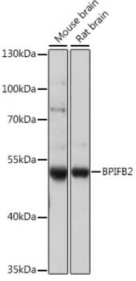 Western Blot: BPIL1 Antibody [NBP2-92302] - Analysis of extracts of various cell lines, using BPIL1 at 1:1000 dilution.Secondary antibody: HRP Goat Anti-Rabbit IgG (H+L) at 1:10000 dilution.Lysates/proteins: 25ug per lane.Blocking buffer: 3% nonfat dry milk in TBST.Detection: ECL Basic Kit .Exposure time: 15s.