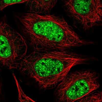 Immunocytochemistry/Immunofluorescence: BPNT1 Antibody [NBP2-14359] - Immunofluorescent staining of human cell line HEK 293 shows localization to nuclear speckles.