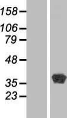 Western Blot: BPNT1 Overexpression Lysate (Adult Normal) [NBP2-07667] Left-Empty vector transfected control cell lysate (HEK293 cell lysate); Right -Over-expression Lysate for BPNT1.