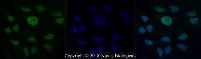 Immunocytochemistry/Immunofluorescence: BRCA1 Antibody (KEN) - Azide and BSA Free [NBP2-80601] - HeLa cells were fixed for 10 minutes using 10% formalin and then permeabilized for 5 minutes using 1X PBS + 0.5% Triton-X100. The cells were incubated with anti-BRCA1 (KEN) at 5 ug/ml overnight at 4C and detected with an anti-mouse Dylight 488 (Green) at a 1:500 dilution. Nuclei were counterstained with DAPI (Blue). Cells were imaged using a 40X objective. Image from the standard format of this antibody.