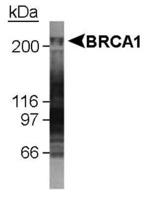 Western Blot: BRCA1 Antibody (KEN) - Azide and BSA Free [NBP2-80601] - Detection of BRCA1 in U2OS whole cell lysate using NB 100-599. 1 minute ECL detection. Image from the standard format of this antibody.