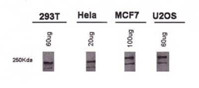 Western Blot: BRCA1 Antibody (MU) - Azide and BSA Free [NBP2-80602] - Detection of BRCA1 using NB100-600. Image from the standard format of this antibody.